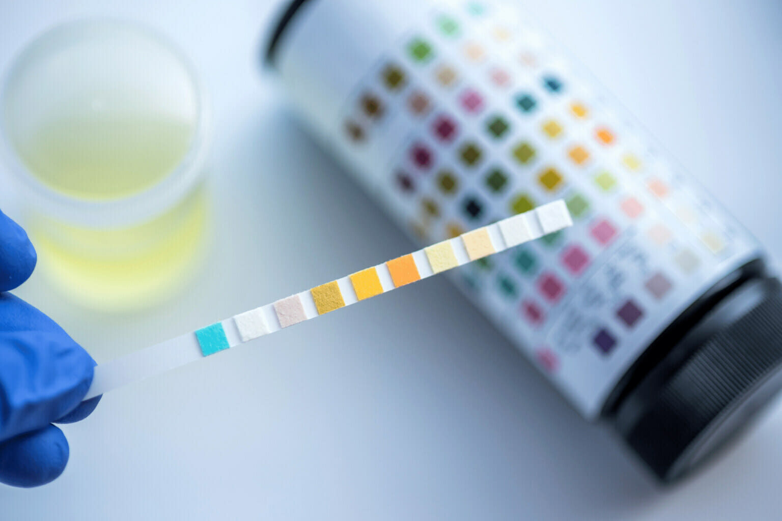 DELTA-8 THC AND DRUG TESTS WILL YOU PASS? OR WILL YOU FAIL?